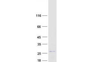 Western Blotting (WB) image for Malignant T Cell Amplified Sequence 1 (MCTS1) (Transcript Variant 1) protein (Myc-DYKDDDDK Tag) (ABIN2725663)