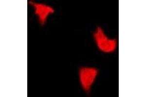 Immunofluorescence (IF) image for anti-Insulin Receptor Substrate 1 (IRS1) (pSer312) antibody (ABIN7302992)