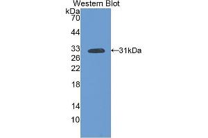 Western Blotting (WB) image for anti-Fms-Related tyrosine Kinase 1 (VEGFR1) (FLT1) (AA 303-524) antibody (ABIN3206008) (FLT1 抗体  (AA 303-524))