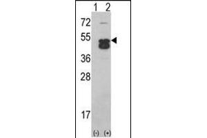 Western blot analysis of CK1D (arrow) using CK1D (CK1 delta)Antibody (C-term) (ABIN391307 and ABIN2841342). (CAMK1D 抗体  (C-Term))