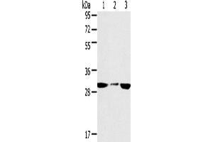 Western Blotting (WB) image for anti-Succinate Dehydrogenase Complex, Subunit B, Iron Sulfur (Ip) (SDHB) antibody (ABIN2433756) (SDHB 抗体)
