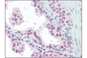 anti-Ubiquitin A-52 Residue Ribosomal Protein Fusion Product 1 (UBA52) (C-Term) antibody