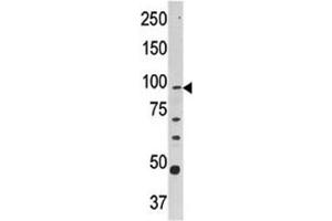 Western blot analysis of CPT1A antibody and Y79 lysate (CPT1A 抗体  (AA 606-636))