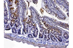 IHC analysis of Cytochrome C using anti-Cytochrome C antibody .