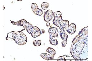 IHC analysis of RPS5 using anti-RPS5 antibody (ABIN7599076).