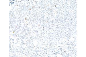 anti-Killer Cell Lectin-Like Receptor Subfamily C, Member 1 (KLRC1) (AA 1-50) antibody