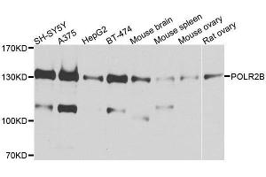 Western blot analysis of extracts of various cell lines, using POLR2B antibody. (POLR2B 抗体  (AA 1-260))