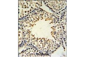 Immunohistochemistry (Paraffin-embedded Sections) (IHC (p)) image for anti-Acyl-CoA Synthetase Bubblegum Family Member 2 (ACSBG2) (AA 237-265) antibody (ABIN653811)