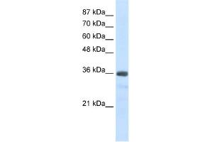 WB Suggested Anti-U1SNRNPBP Antibody Titration:  2. (SNRNP35 抗体  (N-Term))