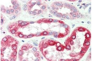Immunohistochemistry (IHC) image for anti-Solute Carrier Family 37 (Glucose-6-Phosphate Transporter), Member 4 (SLC37A4) (AA 38-87) antibody (ABIN6754936)