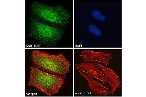ABIN940568 Immunofluorescence analysis of paraformaldehyde fixed HeLa cells, permeabilized with 0. (TERT 抗体  (AA 597-611))