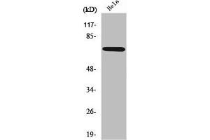 Western Blot analysis of HeLa cells using ABCF2 Polyclonal Antibody (ABCF2 抗体  (Internal Region))