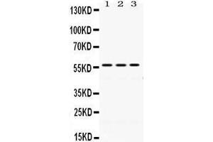 Western Blotting (WB) image for anti-Protein Disulfide Isomerase Family A, Member 3 (PDIA3) (AA 471-505), (C-Term) antibody (ABIN3043898) (PDIA3 抗体  (C-Term))