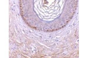 Immunohistochemistry of XEDAR in human skin tissue with this product at 10 μg/ml. (Ectodysplasin A2 Receptor 抗体)