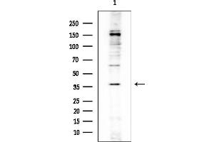 Western blot analysis of lysates from EC304 cells, using OR5R1 Mouse Monoclonal Antibody at 1/1000 dilution.