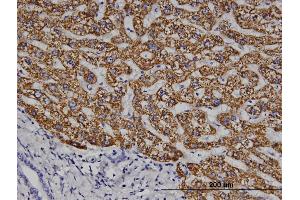 Immunoperoxidase of monoclonal antibody to ELA1 on formalin-fixed paraffin-embedded human liver. (CELA1 抗体  (AA 159-257))