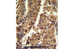 Immunohistochemistry (Paraffin-embedded Sections) (IHC (p)) image for anti-Proteasome (Prosome, Macropain) Activator Subunit 2 (PA28 Beta) (PSME2) (C-Term) antibody (ABIN453317)