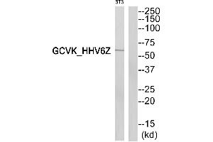 Western blot analysis of extracts from 3T3cells, using GCVK_HHV6Z antibody. (GCVK_HHV6Z 抗体)