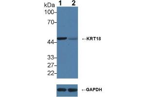 Western blot analysis of (1) Wild-type HeLa cell lysate, and (2) KRT18 knockout HeLa cell lysate, using Rabbit Anti-Human KRT18 Antibody (2 µg/ml) and HRP-conjugated Goat Anti-Mouse antibody ( (Cytokeratin 18 抗体  (AA 238-396))