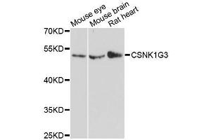 Western blot analysis of extracts of various cell lines, using CSNK1G3 antibody. (CSNK1G3 抗体  (AA 304-423))