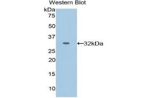 Western blot analysis of the recombinant protein. (EPHA1 抗体  (AA 716-960))
