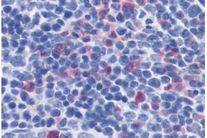 Mouse Spleen: Formalin-Fixed, Paraffin-Embedded (FFPE) (IL-17 抗体)