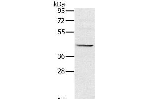 Western Blot analysis of Raji cell using MVK Polyclonal Antibody at dilution of 1:550 (MVK 抗体)