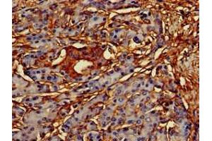 Immunohistochemistry (IHC) image for anti-CAMP Responsive Element Binding Protein 3-Like 1 (CREB3L1) (AA 396-500) antibody (ABIN7148816)
