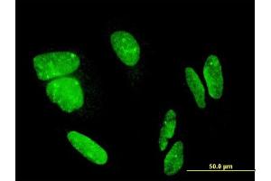 Immunofluorescence of monoclonal antibody to FLJ23834 on HeLa cell. (CDHR3 抗体  (AA 776-885))
