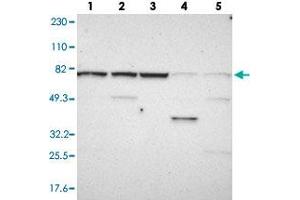 Western blot analysis of Lane 1: RT-4, Lane 2: U-251 MG, Lane 3: Human Plasma, Lane 4: Liver, Lane 5: Tonsil with WDR25 polyclonal antibody  at 1:250-1:500 dilution. (WDR25 抗体)