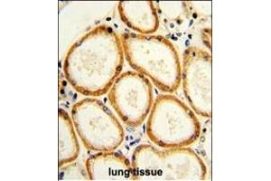 Formalin-fixed and paraffin-embedded human lung with CASP2 Antibody (Center), which was peroxidase-conjugated to the secondary antibody, followed by DAB staining. (Caspase 2 抗体  (AA 198-226))