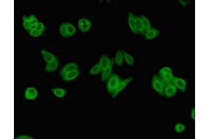 Immunofluorescent analysis of HepG2 cells using ABIN7174147 at dilution of 1:100 and Alexa Fluor 488-congugated AffiniPure Goat Anti-Rabbit IgG(H+L) (ZRSR2 抗体  (AA 191-372))