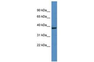 Image no. 1 for anti-Growth Hormone Inducible Transmembrane Protein (GHITM) (AA 161-210) antibody (ABIN6746279) (GHITM 抗体  (AA 161-210))