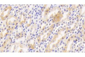 Detection of CTR in Mouse Kidney Tissue using Polyclonal Antibody to Calcitonin Receptor (CTR) (Calcitonin Receptor 抗体  (AA 42-170))