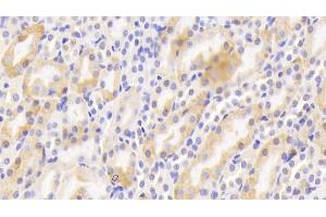Detection of CTR in Mouse Kidney Tissue using Polyclonal Antibody to Calcitonin Receptor (CTR)