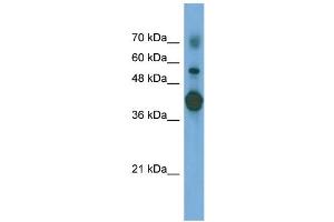 WB Suggested Anti-PTX3 Antibody Titration: 0. (PTX3 抗体  (N-Term))