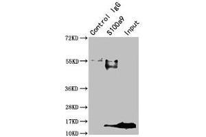 Immunoprecipitating S100a9 in Mouse spleen tissue Lane 1: Rabbit control IgG instead of ABIN7177798 in Mouse spleen tissue. (S1A9 (AA 2-113) 抗体)