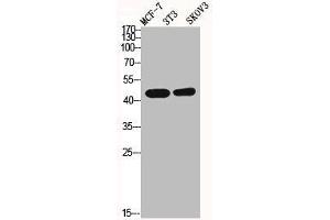 Western Blot analysis of MCF7 NIH-3T3 SKOV3 cells using ICAD Polyclonal Antibody (DFFA 抗体  (Internal Region))