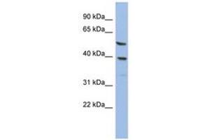 Image no. 1 for anti-Oleoyl-ACP Hydrolase (OLAH) (AA 35-84) antibody (ABIN6744030) (OLAH 抗体  (AA 35-84))