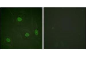 Immunofluorescence analysis of HeLa cells, using Histone H3 (Acetyl-Lys23) Antibody. (Histone 3 抗体  (H3K23ac))
