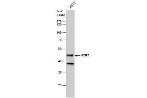 WB Image DOK2 antibody [N1C1] detects DOK2 protein by western blot analysis. (DOK2 抗体)