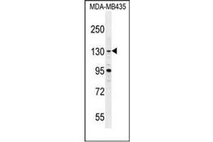 Western blot analysis of GLTSCR1 Antibody (Center) in MDA-MB435 cell line lysates (35ug/lane). (Gltscr1 抗体  (Middle Region))