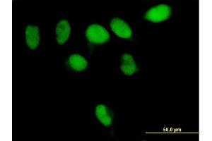 Immunofluorescence of purified MaxPab antibody to PARG on HeLa cell. (PARG 抗体  (AA 1-976))