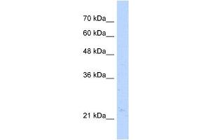 Western Blot showing NUDT16L1 antibody used at a concentration of 1-2 ug/ml to detect its target protein.