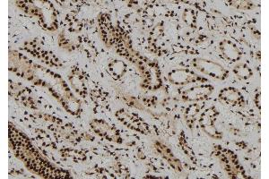 ABIN6273108 at 1/100 staining Human kidney tissue by IHC-P. (DBR1 抗体)