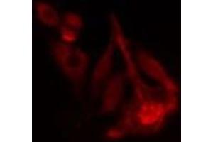 ABIN6277795 staining  Hela cells by IF/ICC.