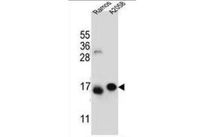 EIF5AL1 抗体  (C-Term)