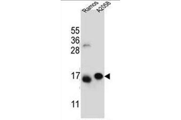 EIF5AL1 抗体  (C-Term)