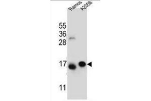 EIF5AL1 Antibody (C-term) western blot analysis in Ramos,A2058 cell line lysates (35µg/lane). (EIF5AL1 抗体  (C-Term))