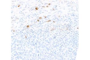Immunohistochemistry (IHC) image for anti-CD80 (CD80) (AA 35-246) antibody (ABIN7449415) (Recombinant CD80 抗体  (AA 35-246))